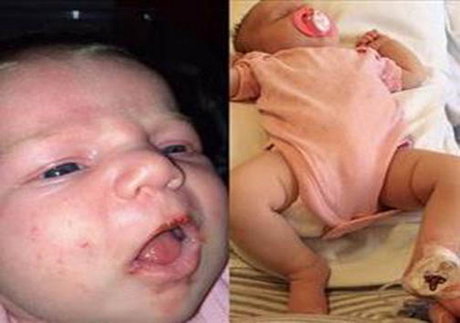 تولد یک نوزاد با ترکشی در سر! + عکس تولد یک نوزاد با ترکشی در سر! + عکس