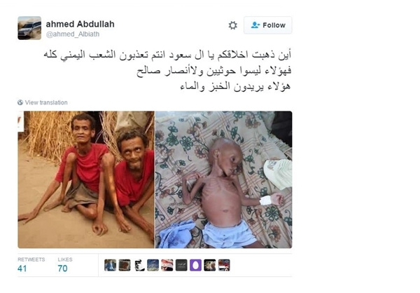 مرگ میلیون‌ها یمنی در «جنگ فراموش شده»