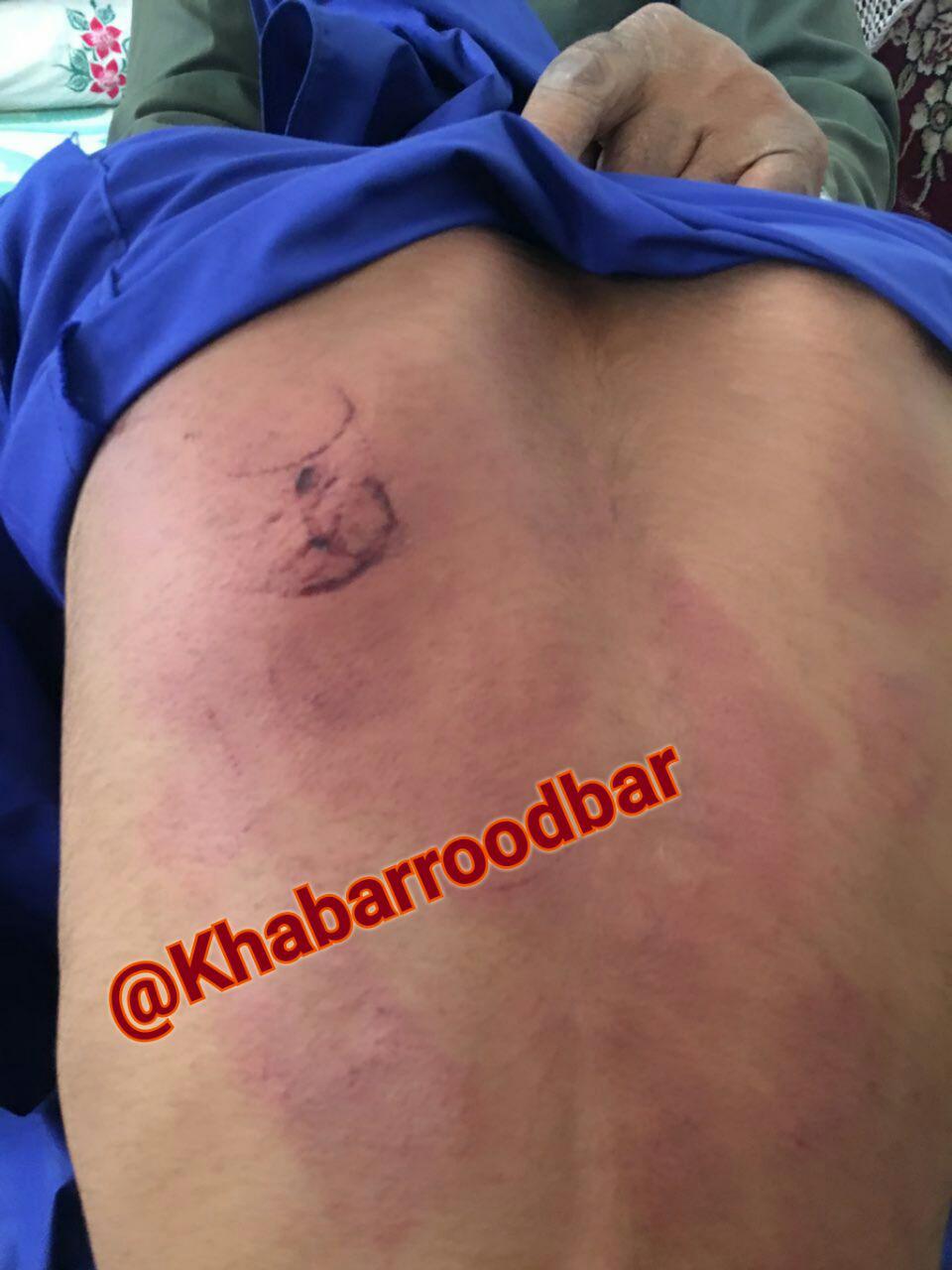 تنبیه بیرحمانه دانش آموز توسط معلم+ عکس تنبیه بیرحمانه دانش آموز توسط معلم+ عکس