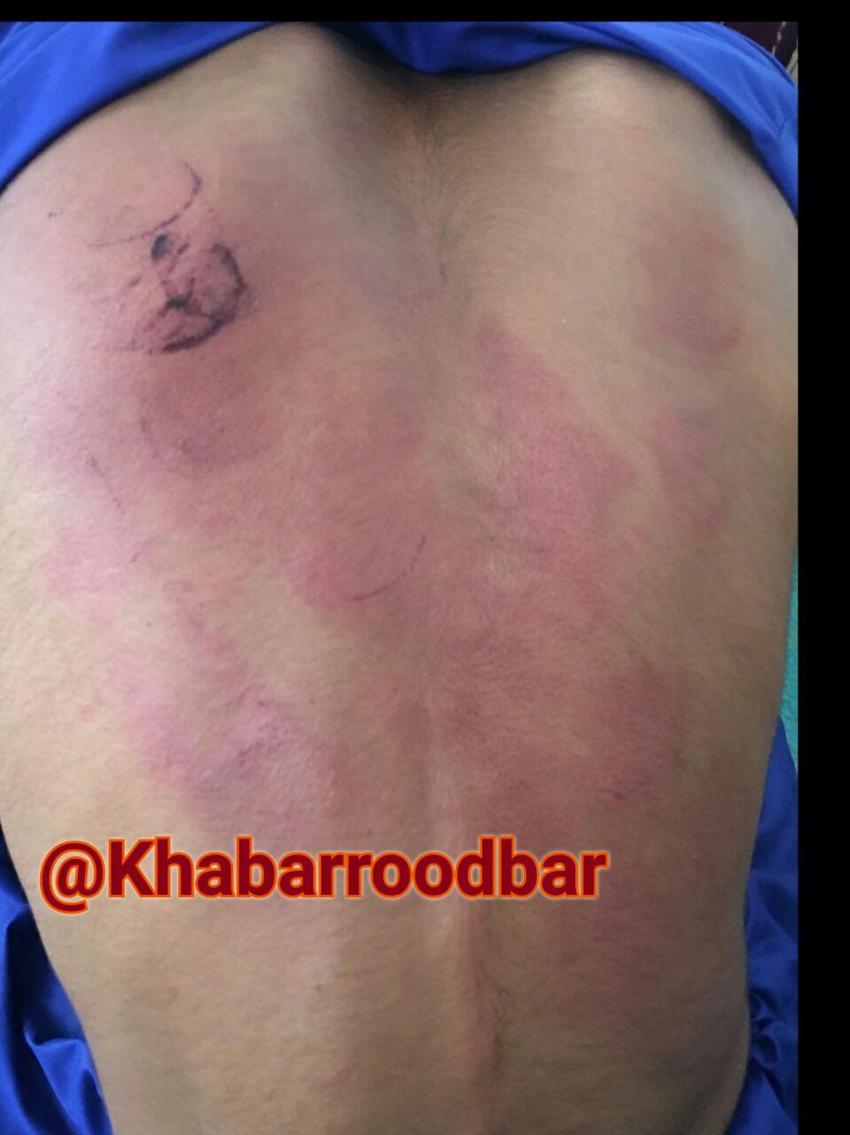تنبیه بیرحمانه دانش آموز توسط معلم+ عکس تنبیه بیرحمانه دانش آموز توسط معلم+ عکس