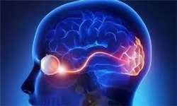 ۸۰ هزار ایرانی مبتلا به اماس ۸۰ هزار ایرانی مبتلا به اماس