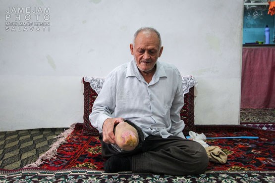 گزارشی تکان‌دهنده از شهرک جذامی‌ها+ تصاویر