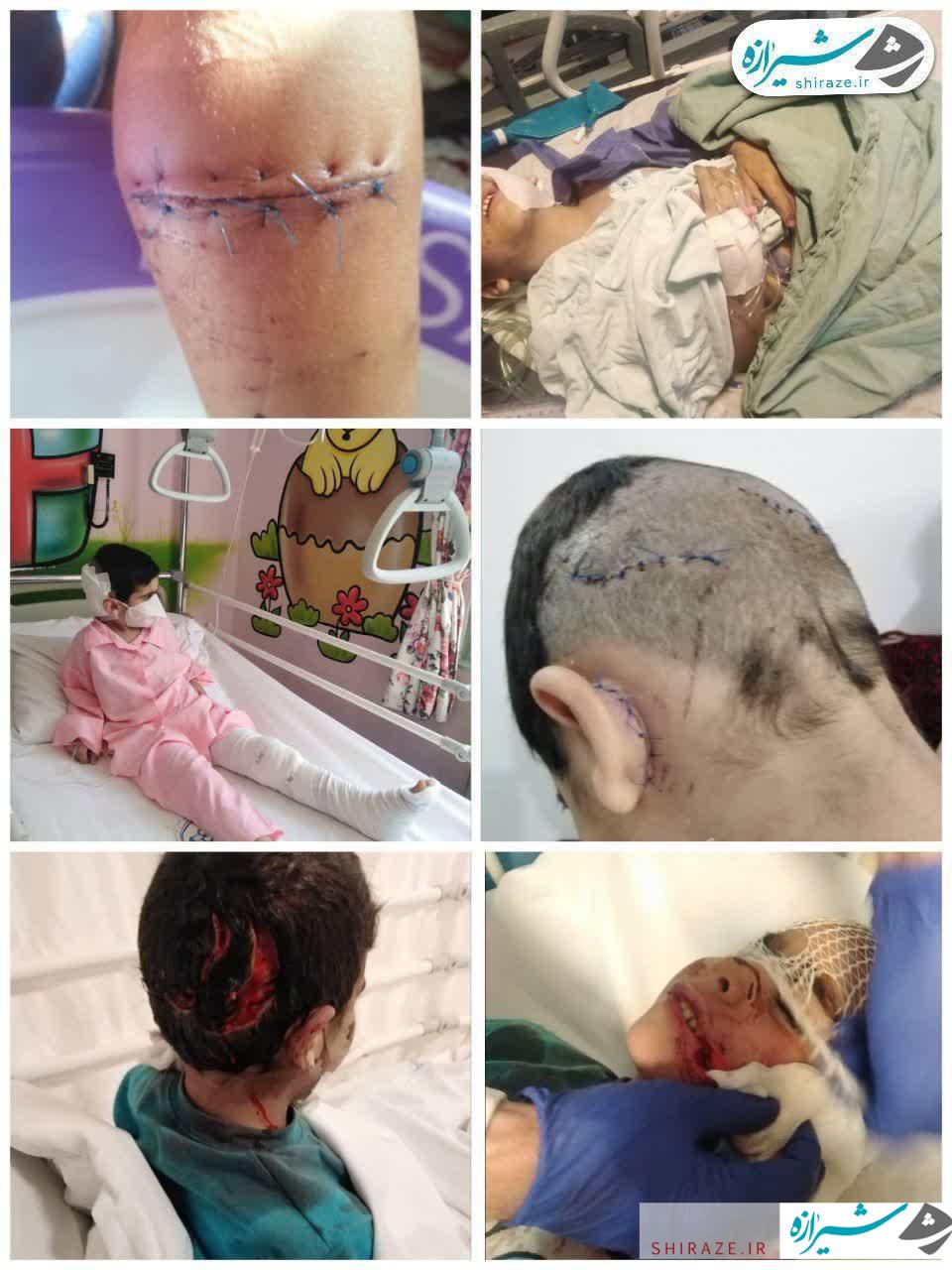 حمله به کودکان همان و فنا شدن جانشان همان!/لزوم جمع آوری سگ ها و عقیم سازی آن ها در این روزهای کرونایی