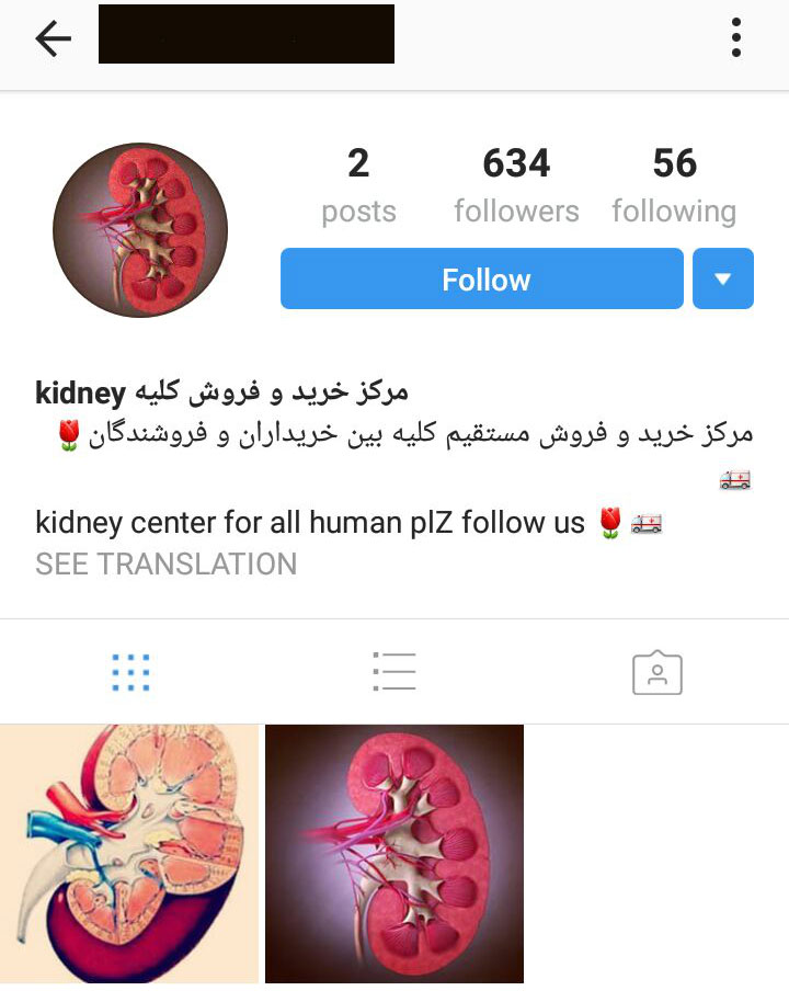 کوچ دلالان اعضای بدن به شبکه های اجتماعی/ هیچ پیوند اعضایی از فرد غریبه در شیراز انجام نمی‌شود