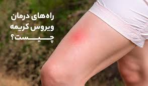 فوت یک بیمار مبتلا به تب فوت یک بیمار مبتلا به تب