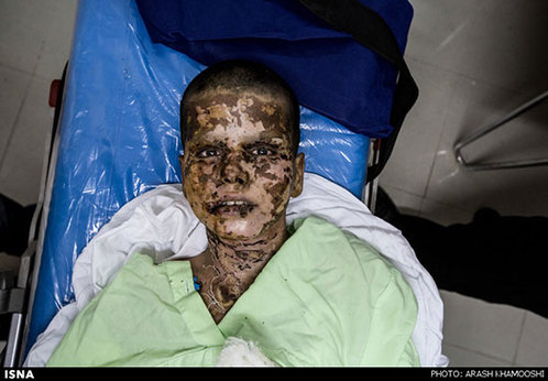 محمدهادی ۱۲ ساله، اسفند ماه ۱۳۹۳ هنگام بازگشت از مدرسه در منطقه مرزی مهران روی مین رفت و پس از 20 روز بستری بودن در بیمارستان اهواز، در گذشت. این عکس ۲۴ ساعت پیش از مرگ محمدهادی، از او گرفته شده است. محمدهادی ۱۲ ساله، اسفند ماه ۱۳۹۳ هنگام بازگشت از مدرسه در منطقه مرزی مهران روی مین رفت و پس از 20 روز بستری بودن در بیمارستان اهواز، در گذشت. این عکس ۲۴ ساعت پیش از مرگ محمدهادی، از او گرفته شده است.